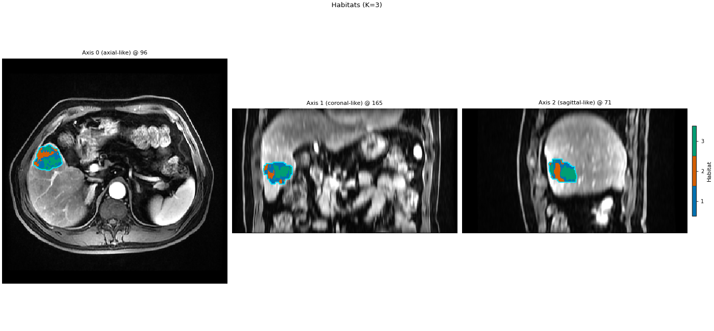 Habitats (K=3), Axis 0 (axial-like) @ 96, Axis 1 (coronal-like) @ 165, Axis 2 (sagittal-like) @ 71