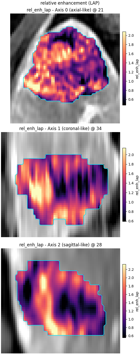 relative enhancement (LAP), rel_enh_lap - Axis 0 (axial-like) @ 21, rel_enh_lap - Axis 1 (coronal-like) @ 34, rel_enh_lap - Axis 2 (sagittal-like) @ 28