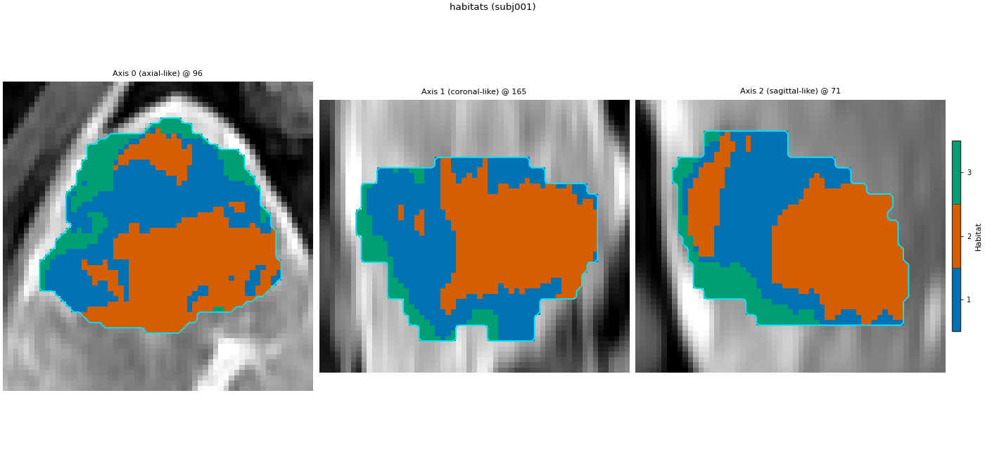 habitats (subj001), Axis 0 (axial-like) @ 96, Axis 1 (coronal-like) @ 165, Axis 2 (sagittal-like) @ 71