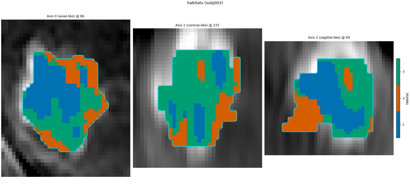 habitats (subj002), Axis 0 (axial-like) @ 86, Axis 1 (coronal-like) @ 233, Axis 2 (sagittal-like) @ 69