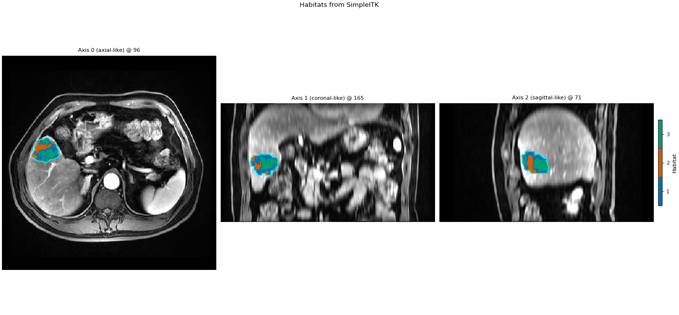 Habitats from SimpleITK, Axis 0 (axial-like) @ 96, Axis 1 (coronal-like) @ 165, Axis 2 (sagittal-like) @ 71