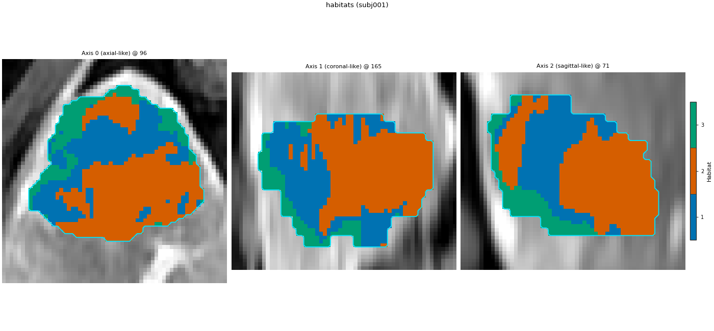 habitats (subj001), Axis 0 (axial-like) @ 96, Axis 1 (coronal-like) @ 165, Axis 2 (sagittal-like) @ 71