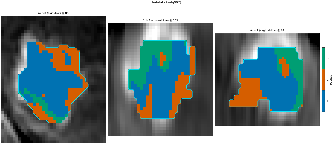 habitats (subj002), Axis 0 (axial-like) @ 86, Axis 1 (coronal-like) @ 233, Axis 2 (sagittal-like) @ 69