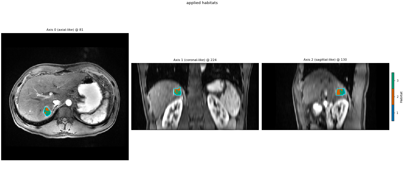 applied habitats, Axis 0 (axial-like) @ 81, Axis 1 (coronal-like) @ 224, Axis 2 (sagittal-like) @ 130