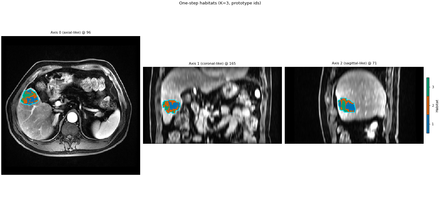 One-step habitats (K=3, prototype ids), Axis 0 (axial-like) @ 96, Axis 1 (coronal-like) @ 165, Axis 2 (sagittal-like) @ 71
