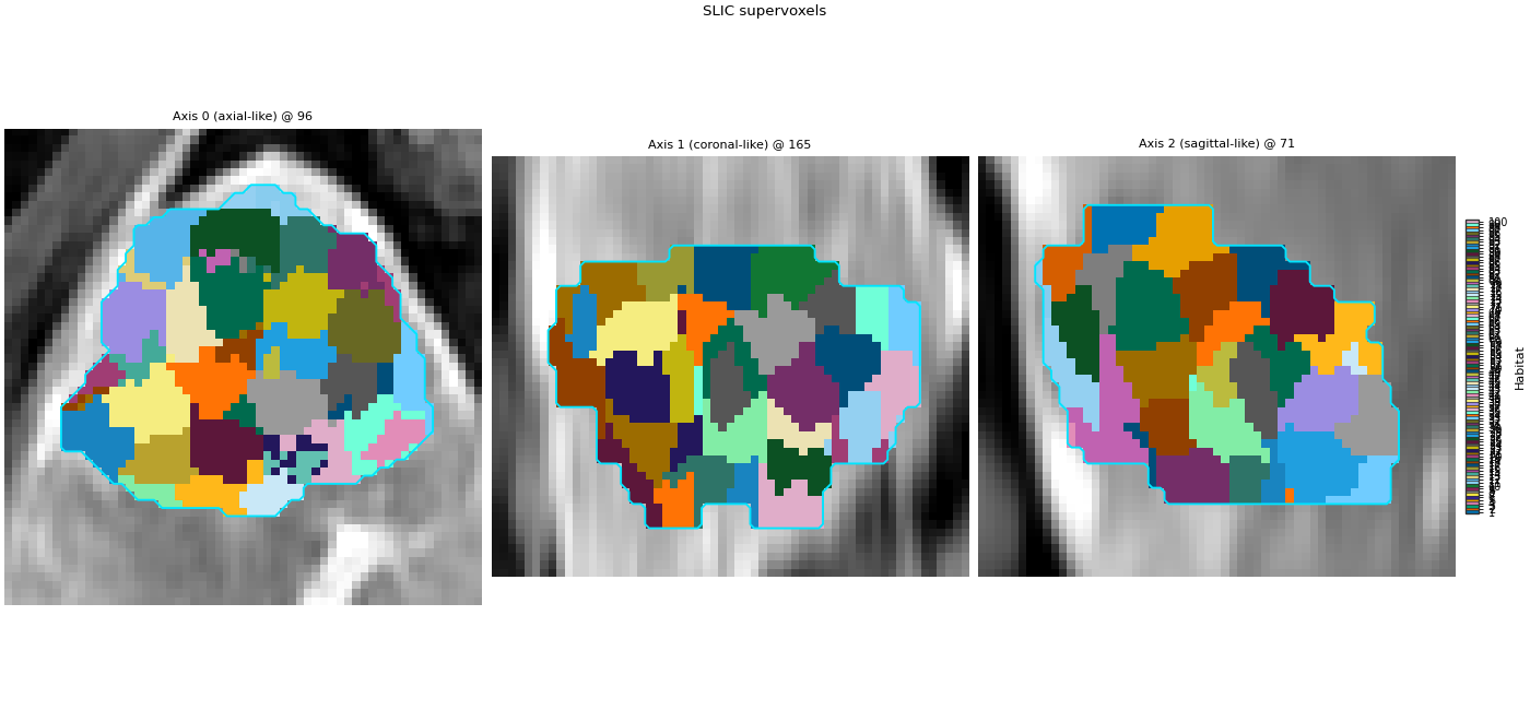 SLIC supervoxels, Axis 0 (axial-like) @ 96, Axis 1 (coronal-like) @ 165, Axis 2 (sagittal-like) @ 71